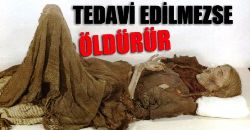 TEDAVİ EDİLMEZSE ÖLDÜRÜR